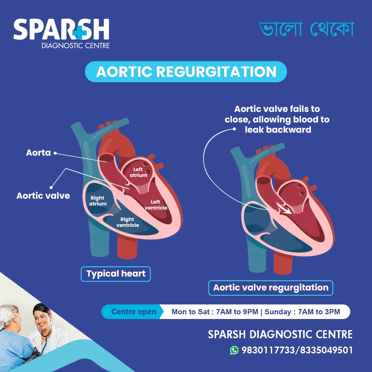 Aortic Regurgitation