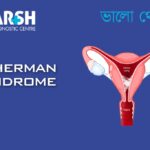Asherman Syndrome