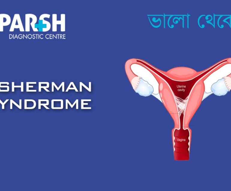 Asherman Syndrome