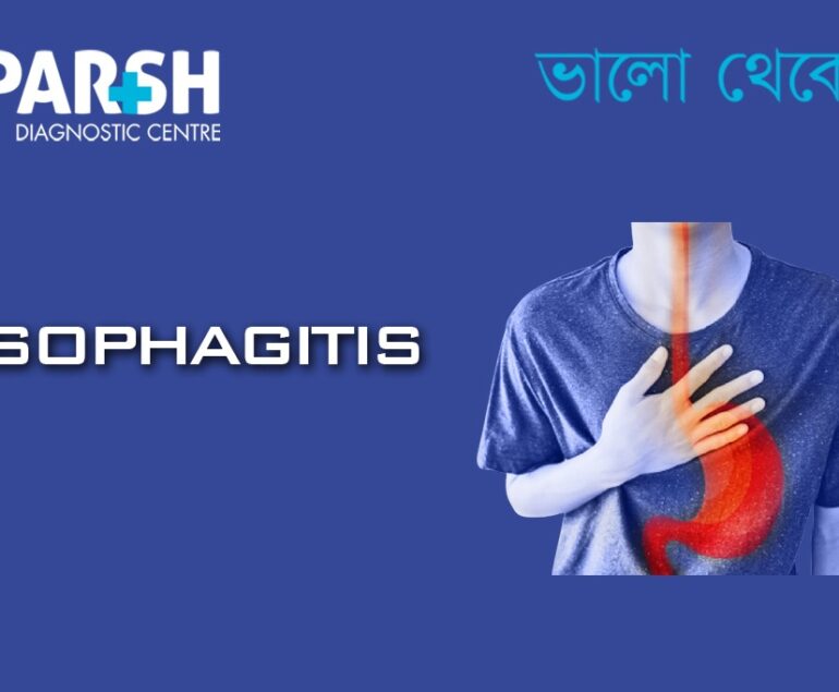 Esophagitis