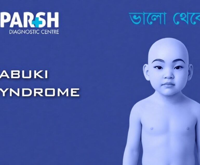 Kabuki Syndrome