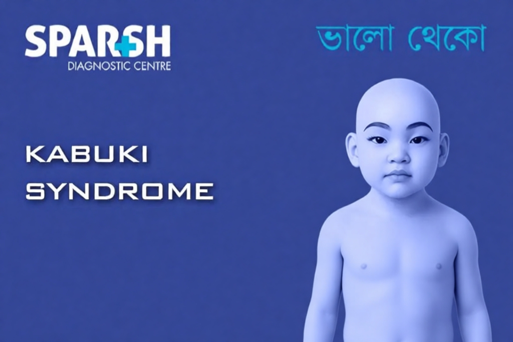 Kabuki Syndrome