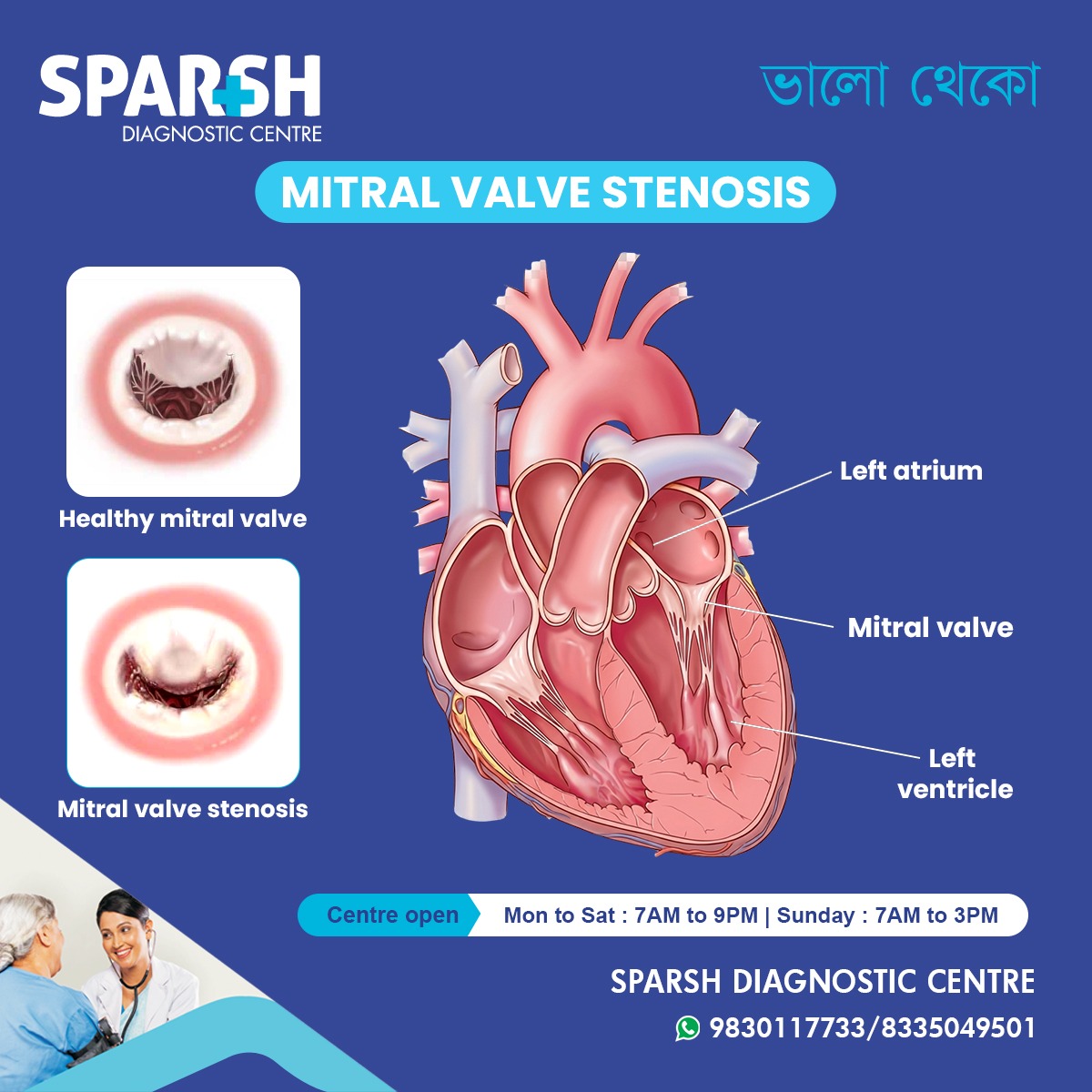 Mitral Valve Stenosis