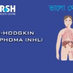 Non Hodgkin Lymphoma CP