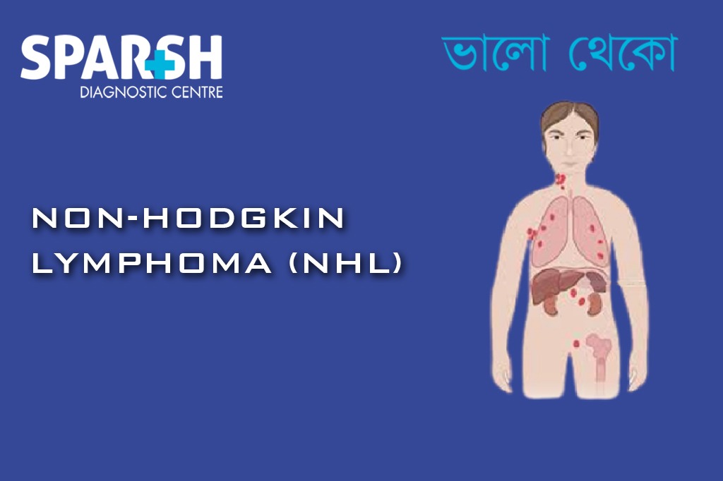 Non Hodgkin Lymphoma CP