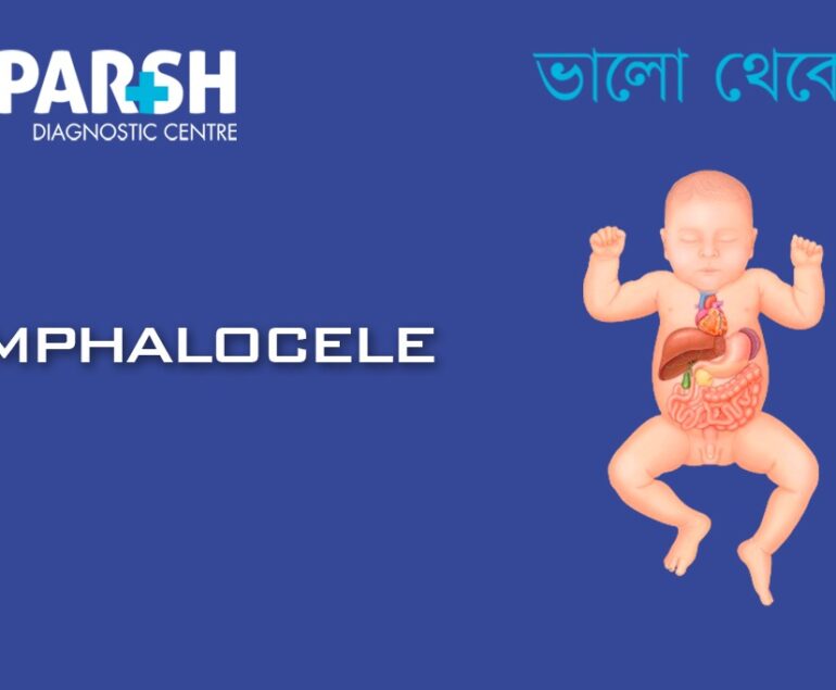 Omphalocele CP