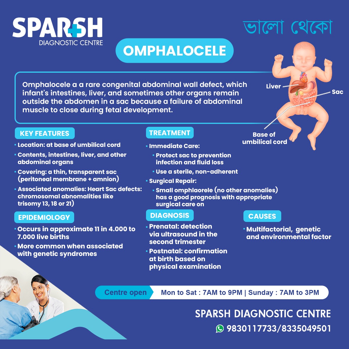 Omphalocele