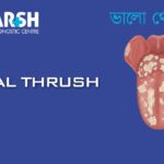 Oral Thrush CP
