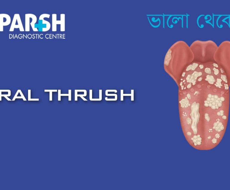 Oral Thrush CP