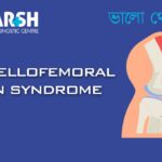 Patellofemoral Pain Syndrome