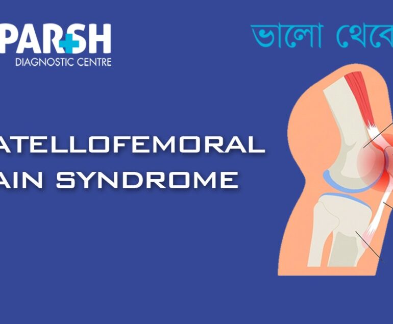 Patellofemoral Pain Syndrome