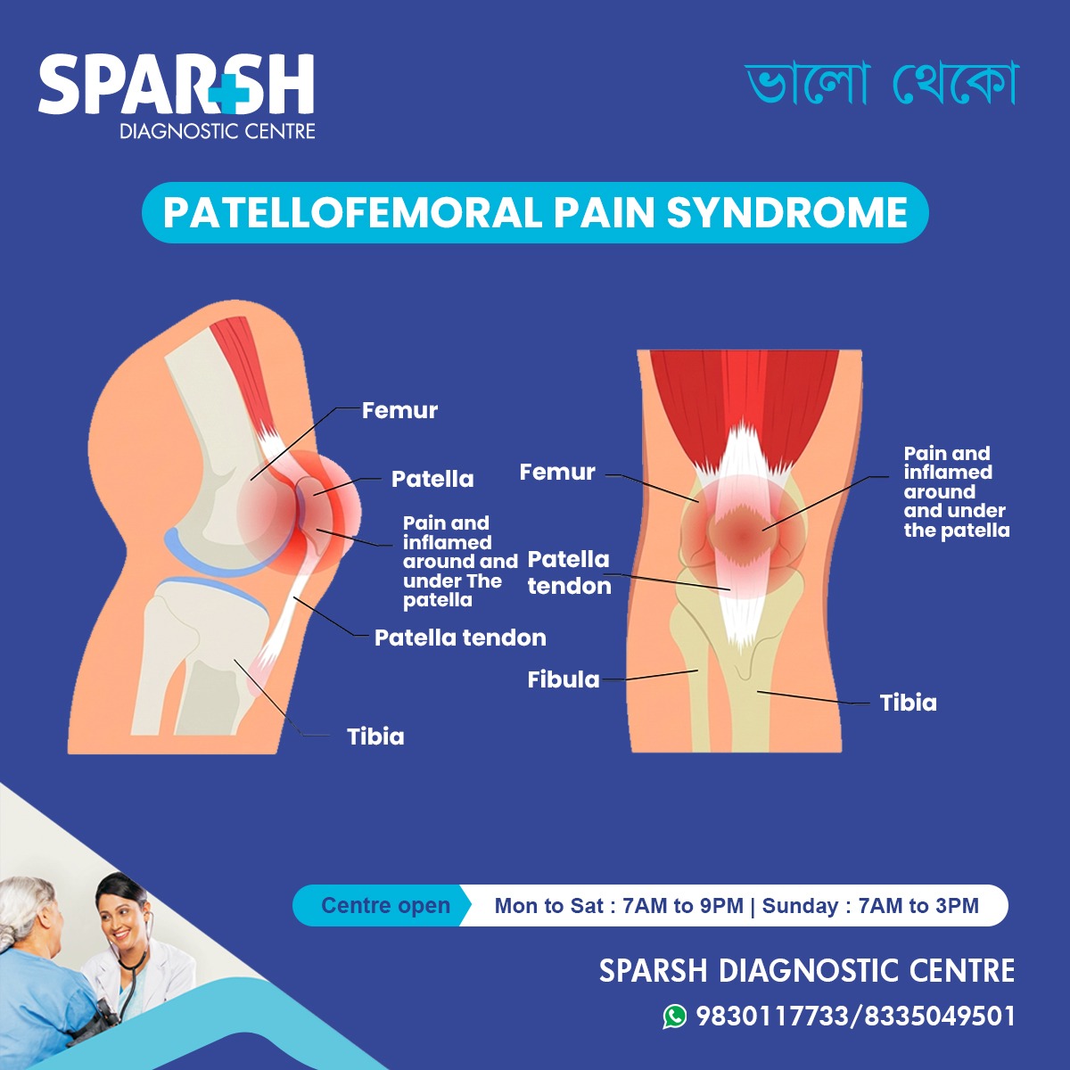 Patellofemoral Pain Syndrome
