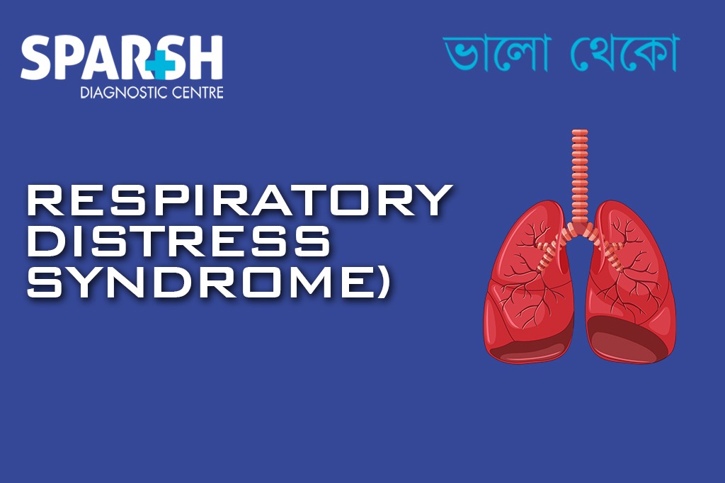 Respiratory Distress Syndrome