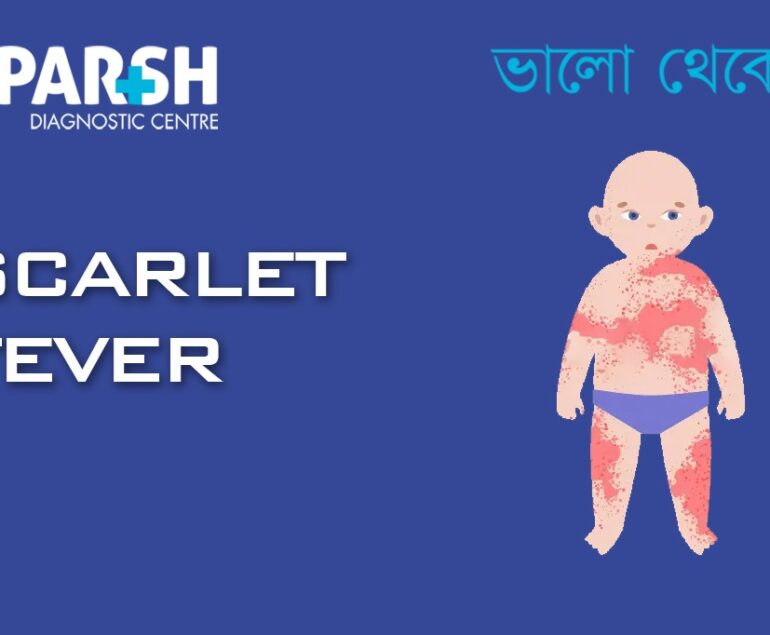 Scarlet Fever