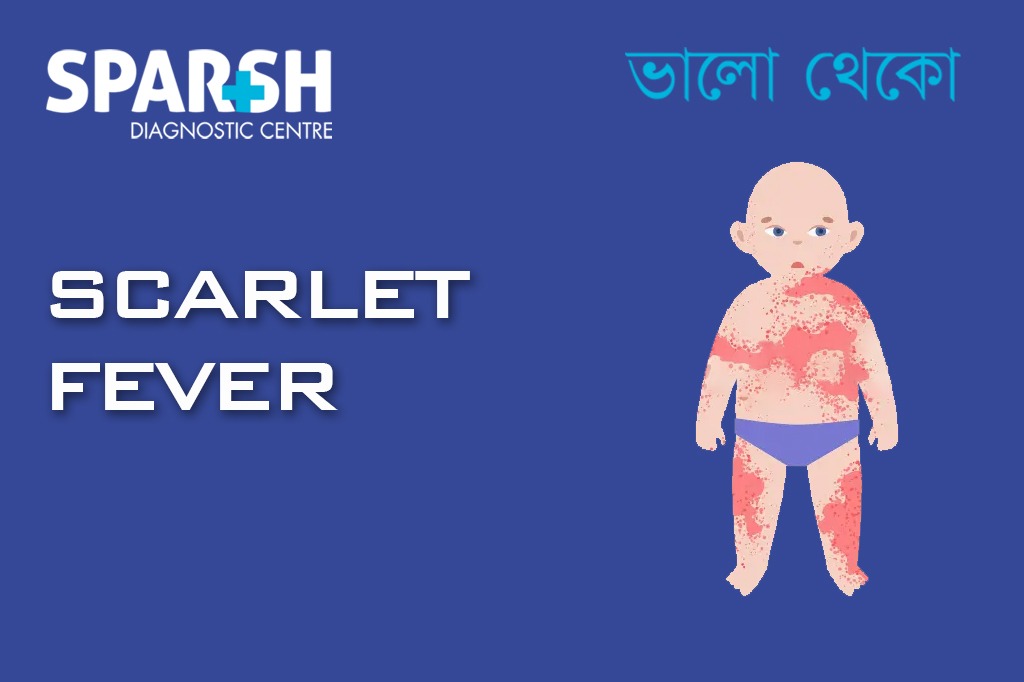 Scarlet Fever