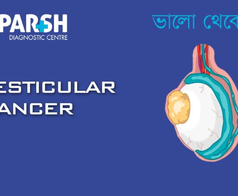 Testicular Cancer