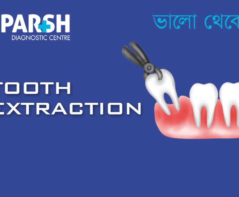 Tooth Extraction
