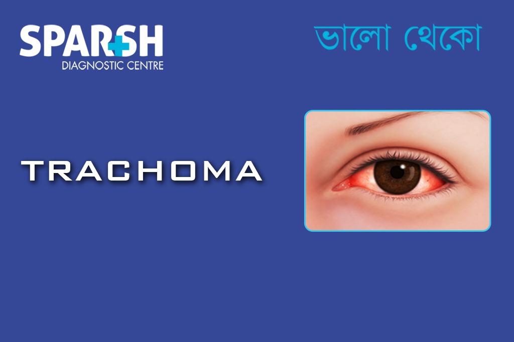 Trachoma CP