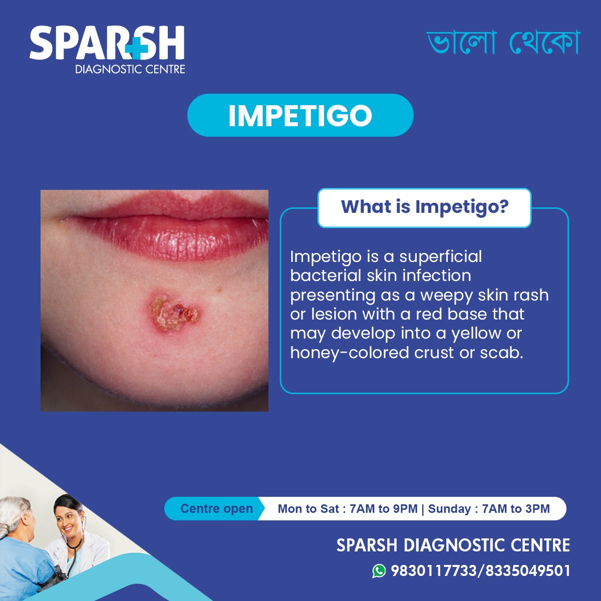 What Is Impetigo