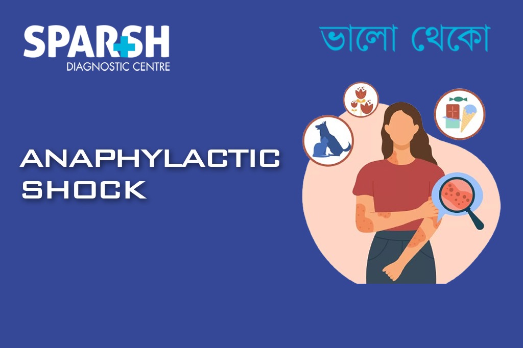 Anaphylactic Shock