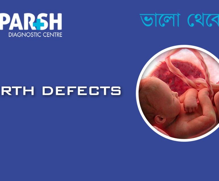 Birth Defects