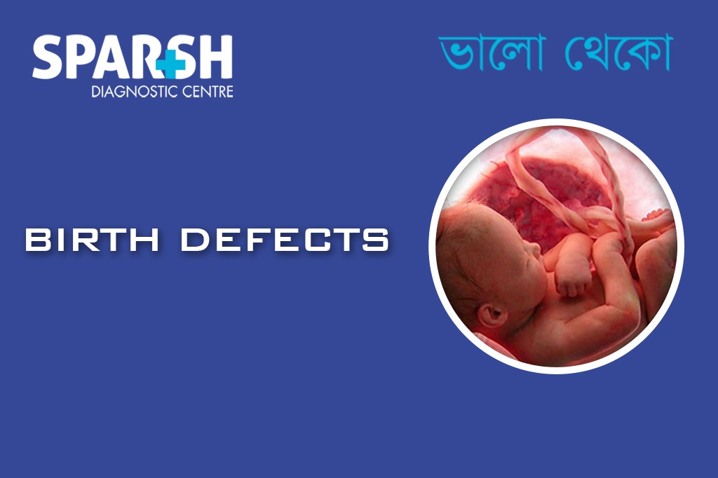 Birth Defects