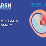 Body Stalk Anomaly