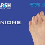 Bunions