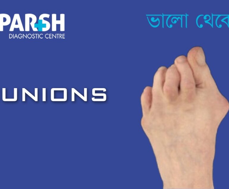Bunions