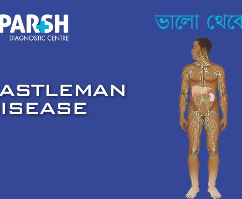 Castleman Disease CP