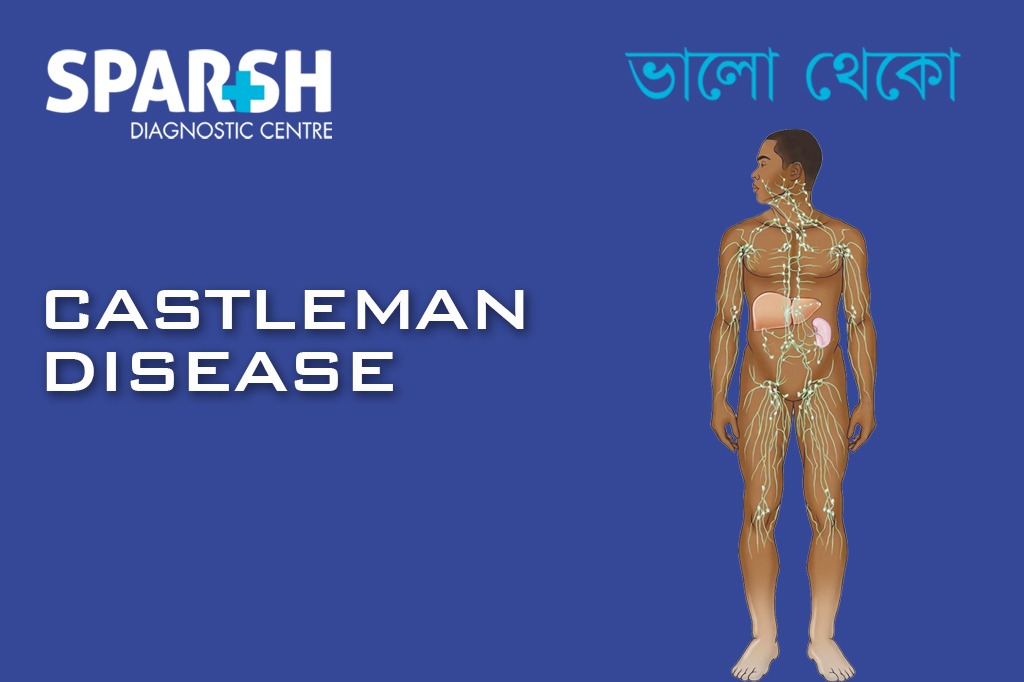 Castleman Disease CP