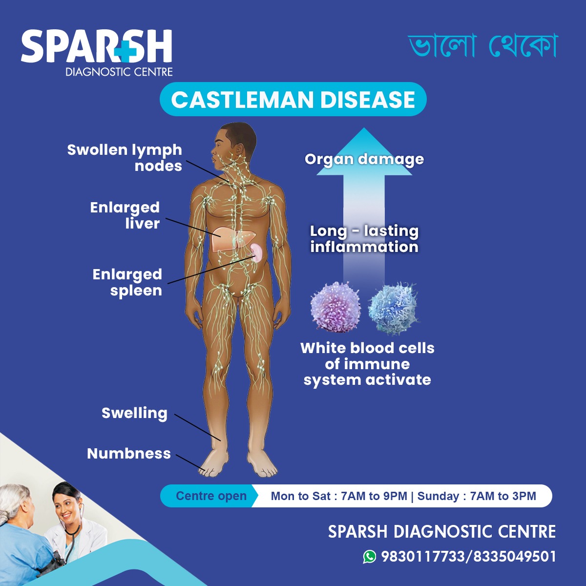Castleman Disease