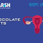 Chocolate Cysts