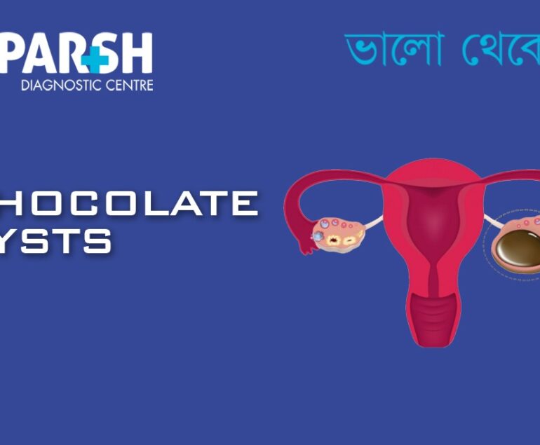 Chocolate Cysts