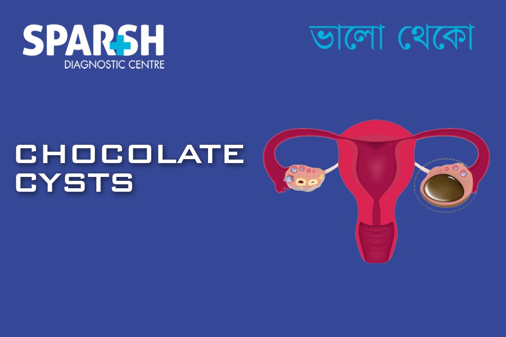 Chocolate Cysts