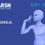 Chorea