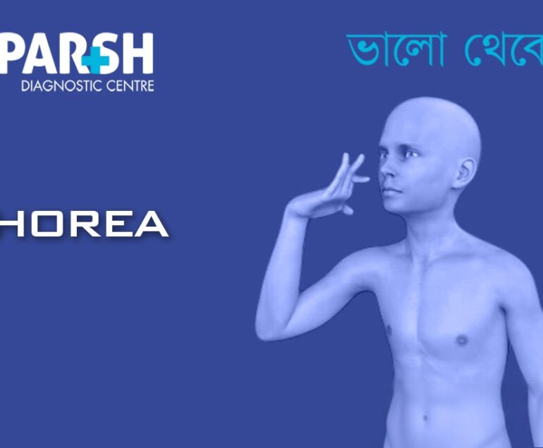 Chorea