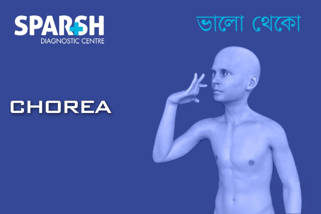 Chorea