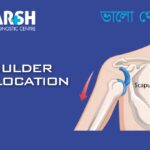 Dislocated Shoulder CP