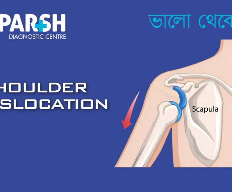 Dislocated Shoulder CP