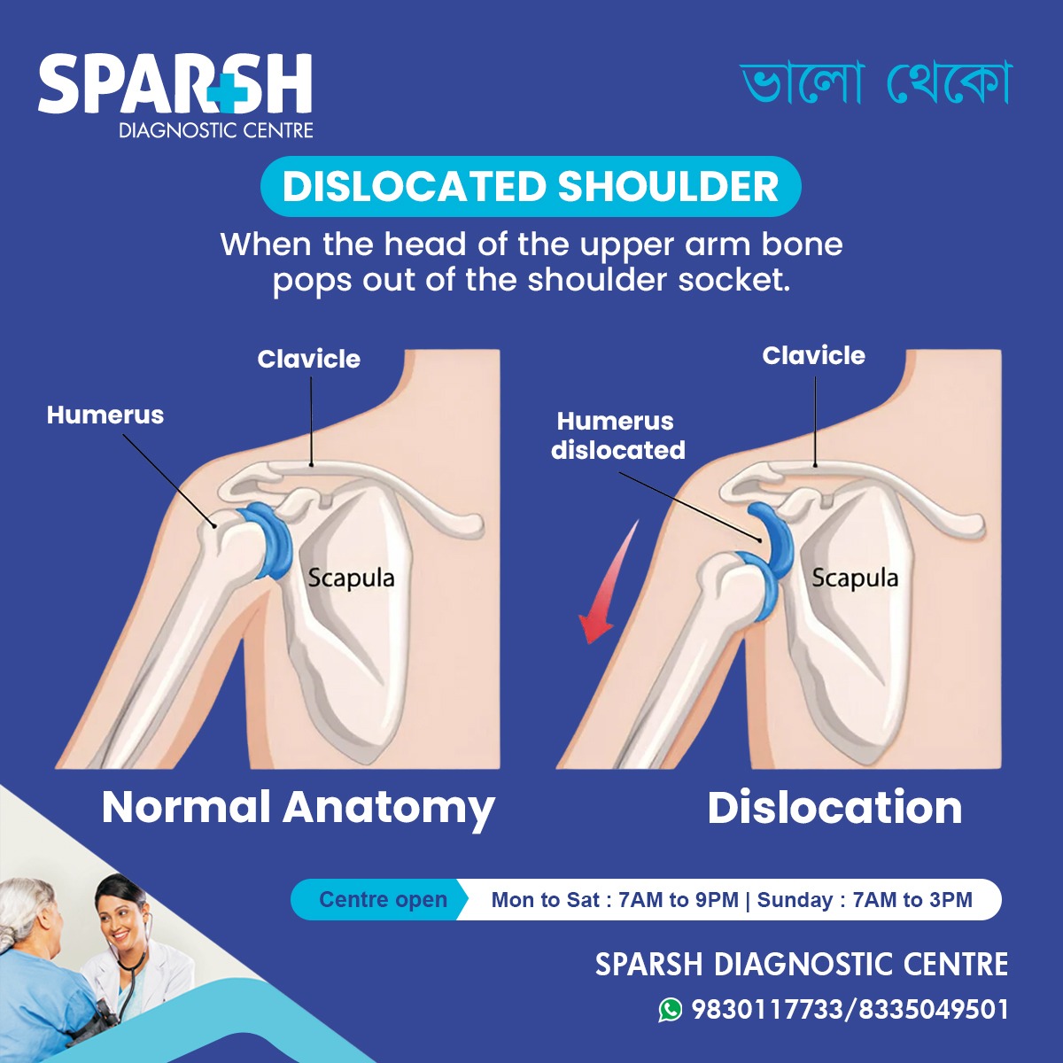 Dislocated Shoulder