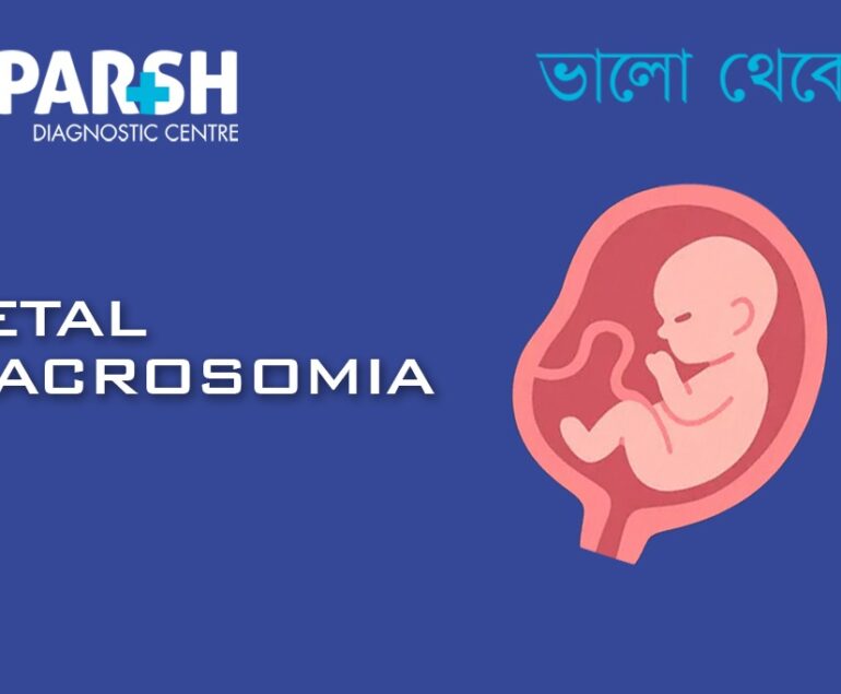 Fetal Macrosomia