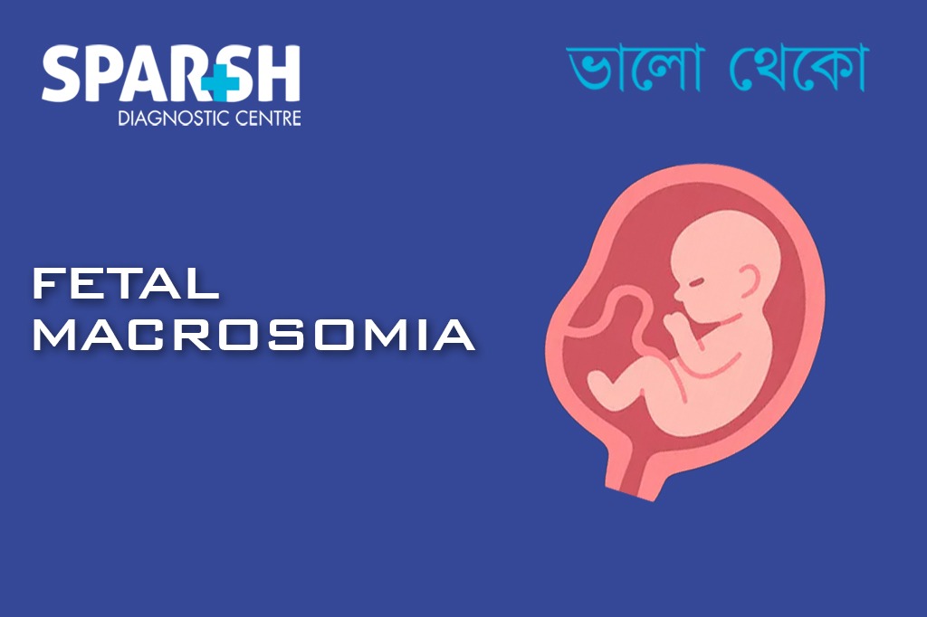 Fetal Macrosomia