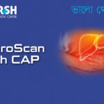 Fibroscan With CAP