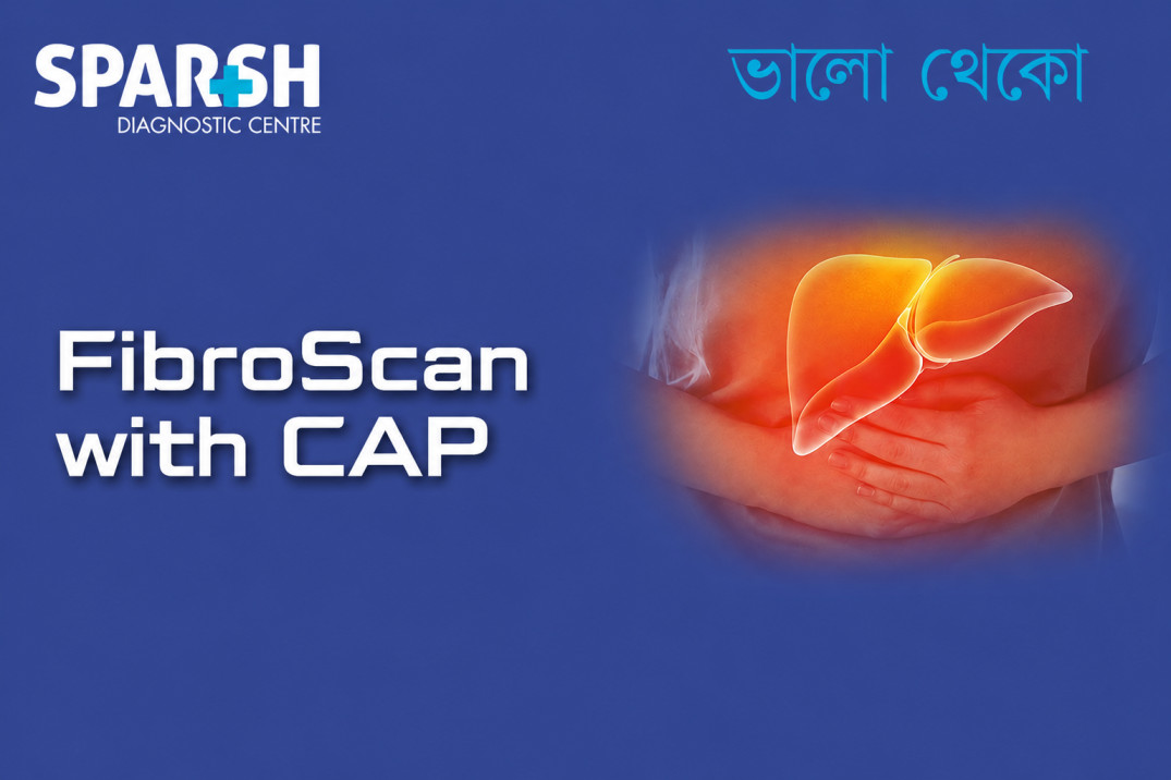 Fibroscan With CAP