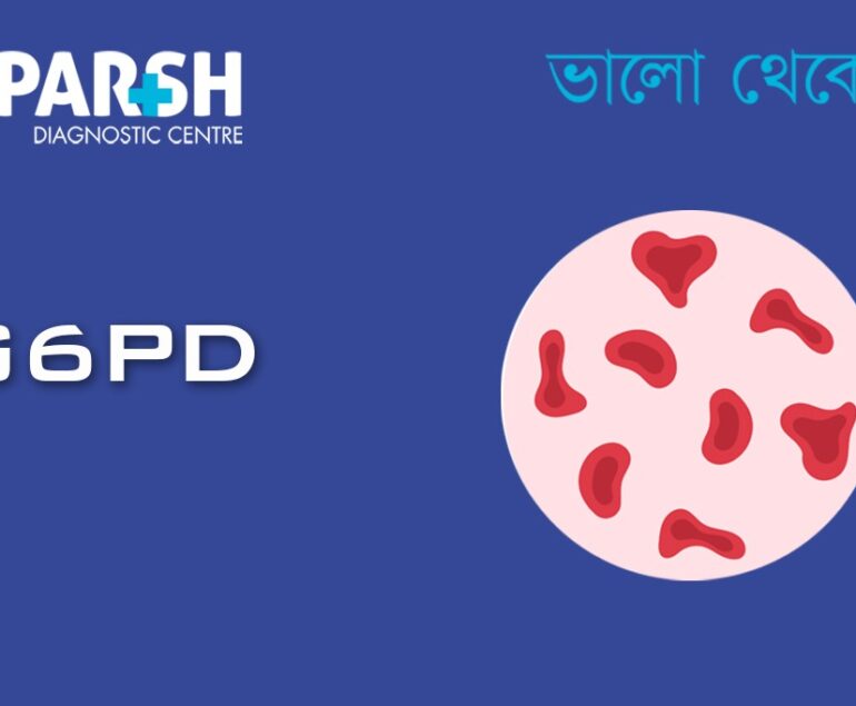 GPD