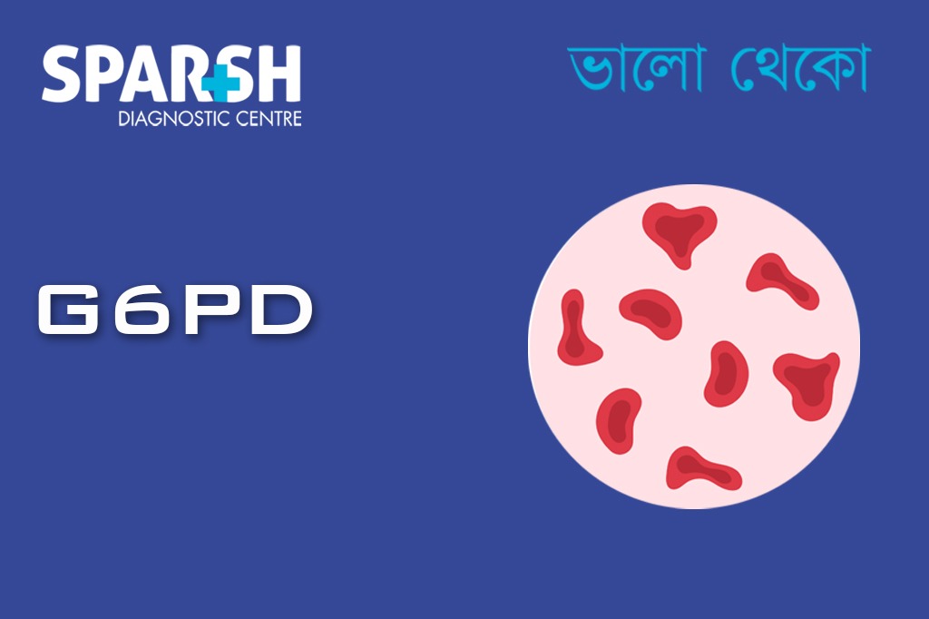 GPD