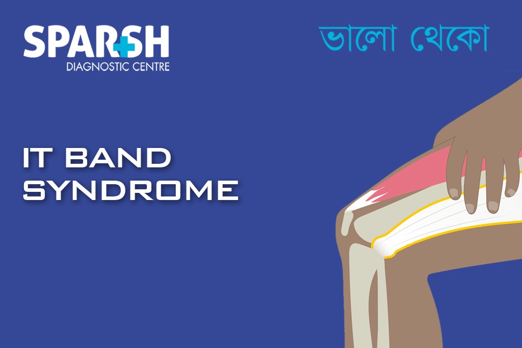 IT Band Syndrome
