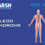 McLeod Syndrome