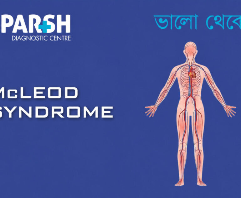 McLeod Syndrome